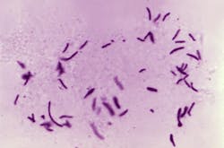 Courtesy of the CDC Courtesy of the CDC