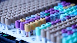 Testalize Me 0j E8yn V4mis Unsplash 6256e9cb4c05e Testalize Me 0j E8yn V4mis Unsplash 6256e9cb4c05e