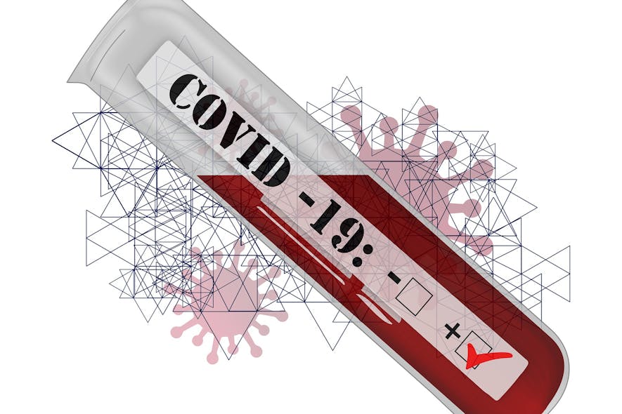 Coronavirus 5675408 1920