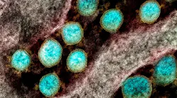 Transmission electron micrograph of SARS-CoV-2 virus particles, isolated from a patient. NIAID.
