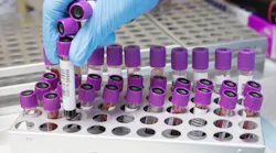 Blood 4944424