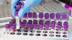 Blood 4944424 627298b60676c Blood 4944424 627298b60676c