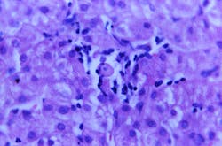 Courtesy of the CDC Courtesy of the CDC