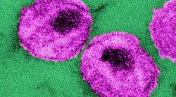 Courtesy of the CDC