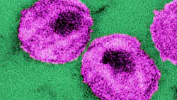 Courtesy of the CDC Courtesy of the CDC