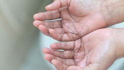 Adobe Stock 266732189 62a89cb288413 Adobe Stock 266732189 62a89cb288413