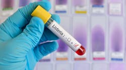 Adobe Stock 195439963 62c45e13af7d4 Adobe Stock 195439963 62c45e13af7d4