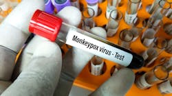 Adobe Stock 505799029 62d0241bcb591 Adobe Stock 505799029 62d0241bcb591