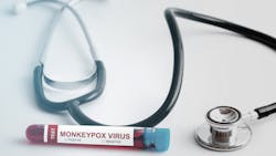 Adobe Stock 506808588 62c465a99bfd2 Adobe Stock 506808588 62c465a99bfd2