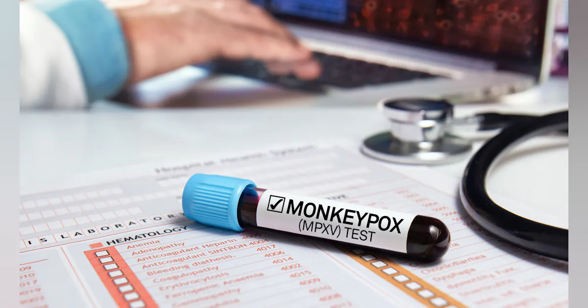 Monkeypox Testing Video Mayo Clinic Labs testing for monkeypox | HPN Online