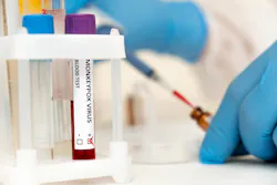 Adobe Stock 507059164 62d6ca3ab8e2a Adobe Stock 507059164 62d6ca3ab8e2a