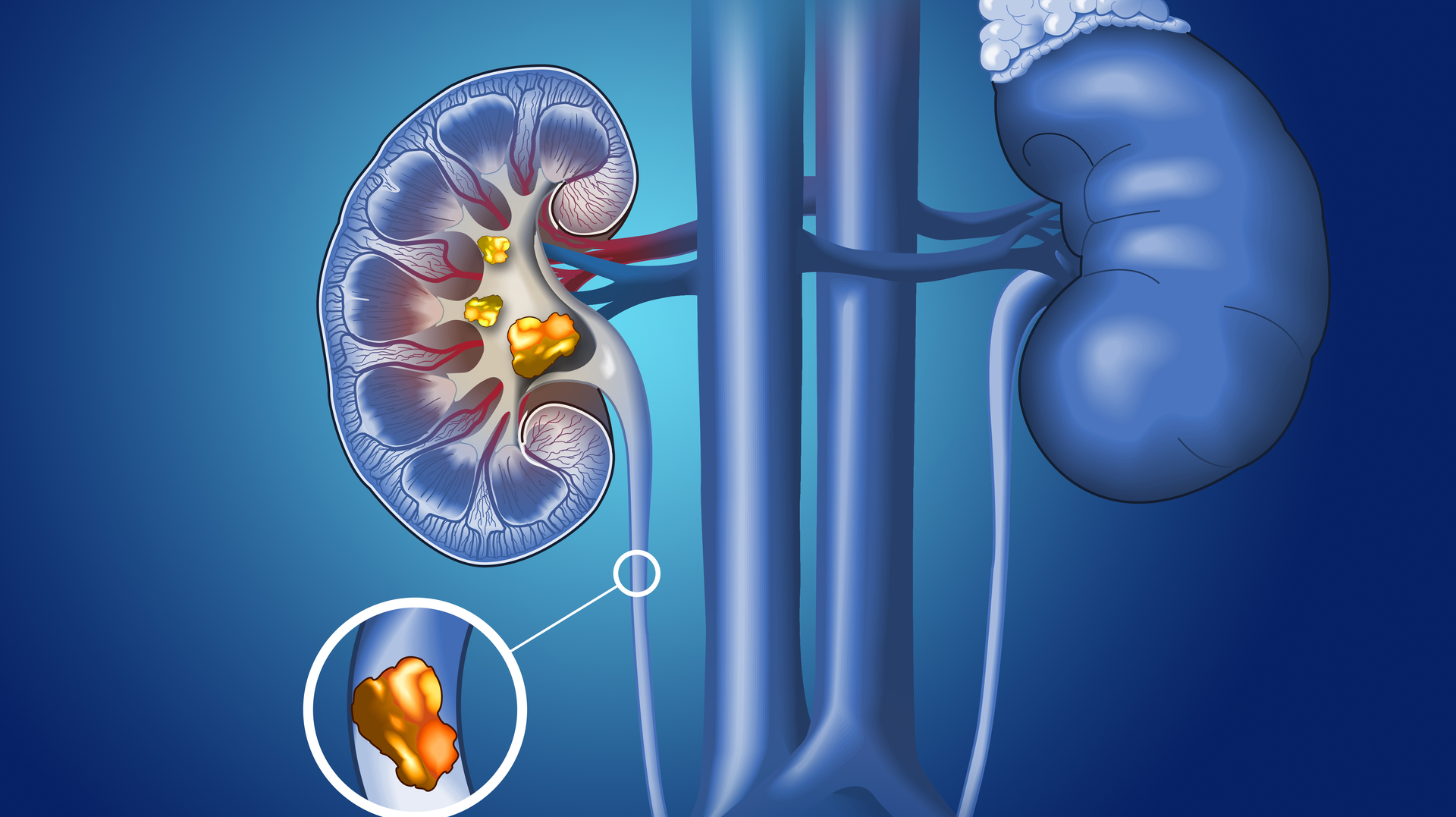 Adobe Stock 326634239 62fe4a509e611