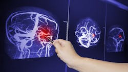 Adobe Stock 423463248 62f516211d035 Adobe Stock 423463248 62f516211d035