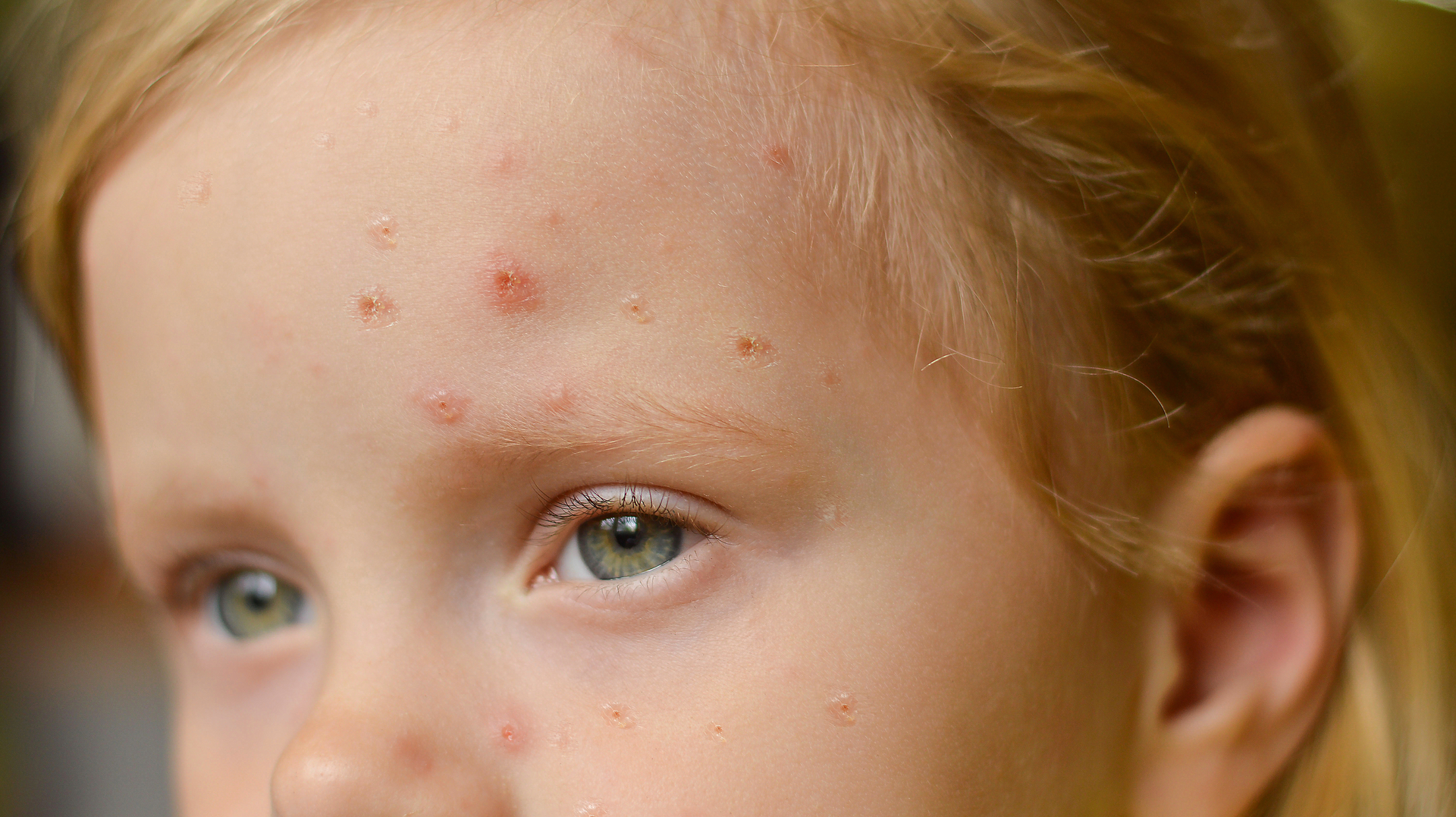 Adobe Stock 506274843 62fd1f2a68bc7