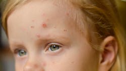 Adobe Stock 506274843 62fd1f2a68bc7 Adobe Stock 506274843 62fd1f2a68bc7