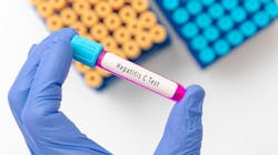 Adobe Stock 517909239 62f3e27dc7ec6 Adobe Stock 517909239 62f3e27dc7ec6