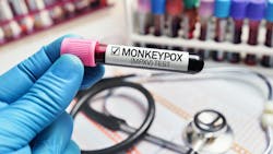 Adobe Stock 506616350 631b7660c0553 Adobe Stock 506616350 631b7660c0553