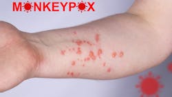 Dreamstime Xs 247970006 63331970e567f Dreamstime Xs 247970006 63331970e567f