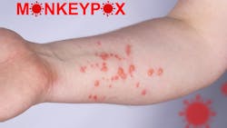 Dreamstime Xs 247970006 63331970e567f Dreamstime Xs 247970006 63331970e567f