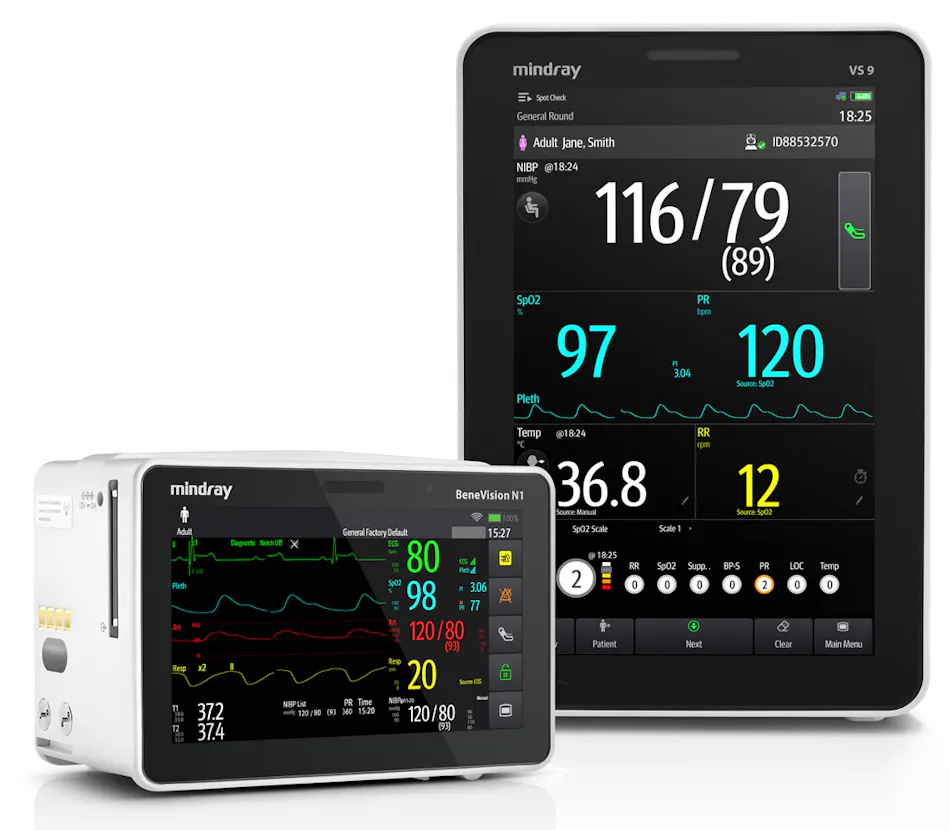 Monitor Mindrey Scope and scale of patient monitoring | Healthcare Purchasing News