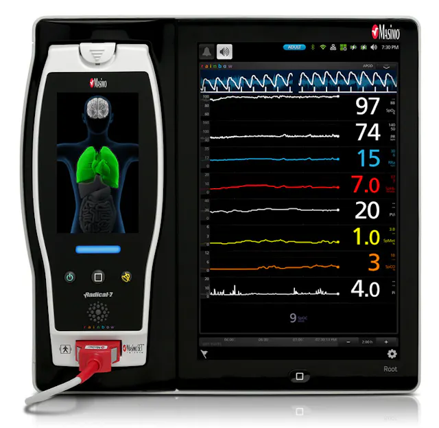 Root Monitor Scope and scale of patient monitoring | Healthcare Purchasing News