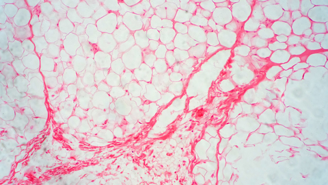 Dreamstime Xs 145163298 633da2a744cb5