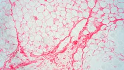 Dreamstime Xs 145163298 633da2a744cb5 Dreamstime Xs 145163298 633da2a744cb5