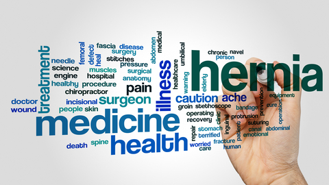 Dreamstime Xs 88379809 635beb1907bc1