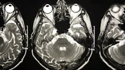 Dreamstime Xs 9265515 6358035d57b14 Dreamstime Xs 9265515 6358035d57b14