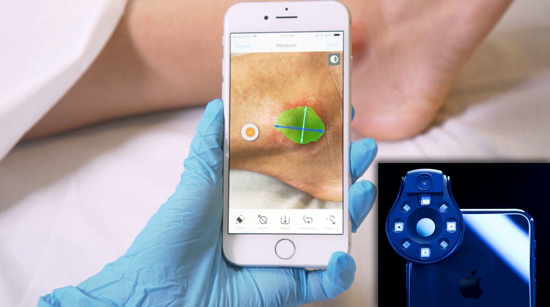 Swift Medical AI-powered, digital wound care platform
