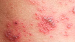 Adobe Stock 184684547 637e564e5098a Adobe Stock 184684547 637e564e5098a