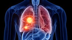 Adobe Stock 282277137 637ba81ba63df Adobe Stock 282277137 637ba81ba63df