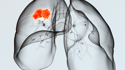 Dreamstime Xs 137231100 636528e4b70dc