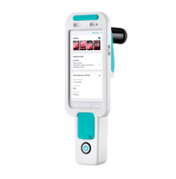 VisualCheck leverages machine learning and augmented intelligence (AI) to assess for normal and abnormal cervical findings VisualCheck leverages machine learning and augmented intelligence (AI) to assess for normal and abnormal cervical findings