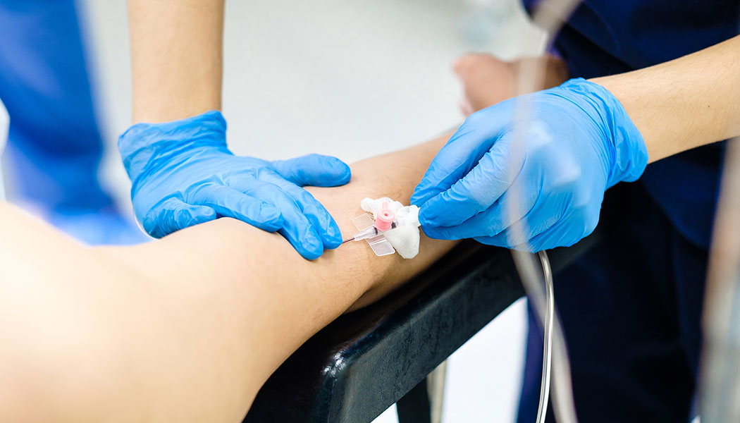 Catheters 63977ad93e4fc