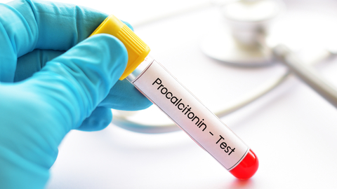 Dreamstime Xs 124791228 63b5ba377f5e5