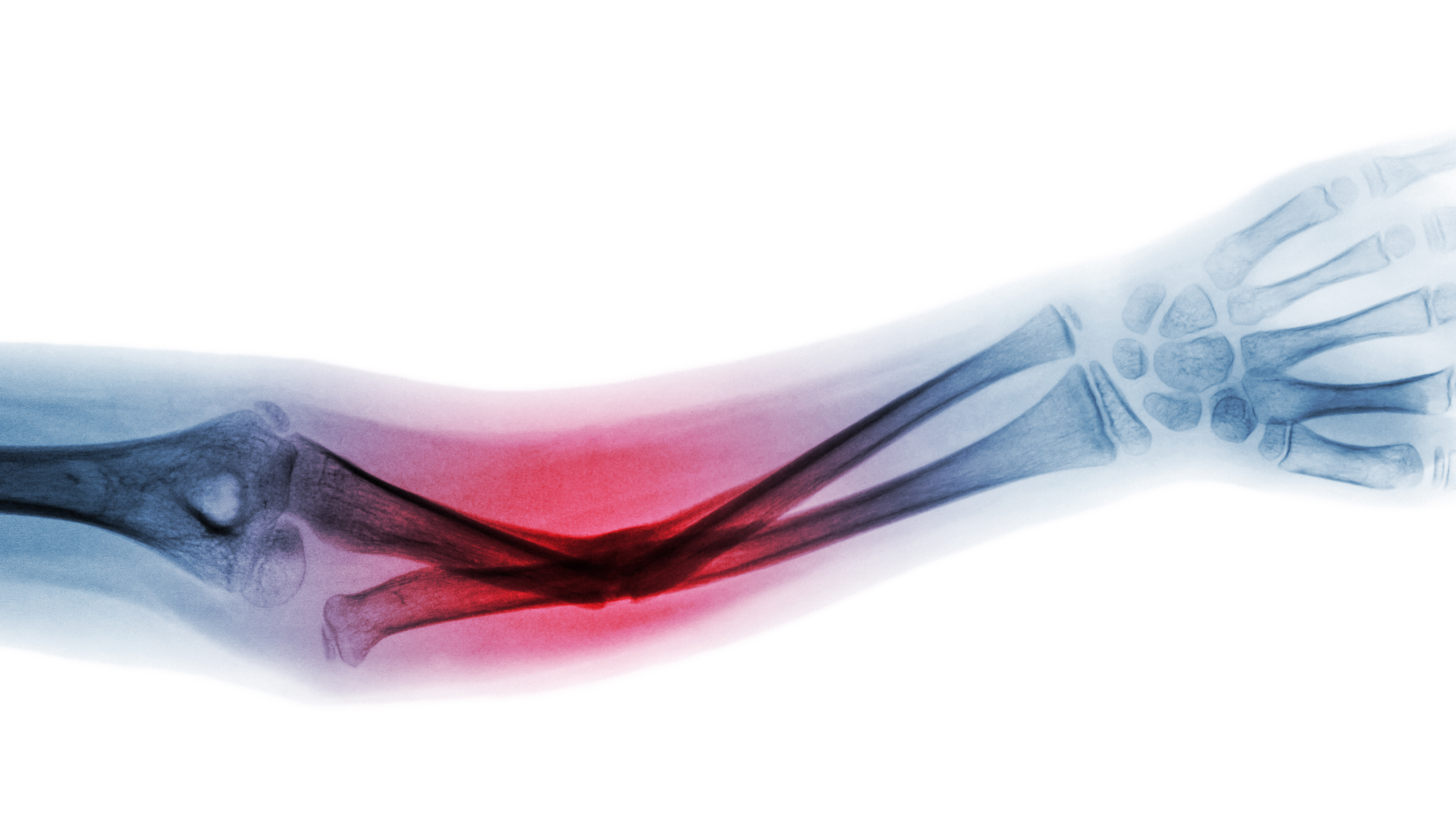 Dreamstime Xxl 96652621 63ce9ec8000c6