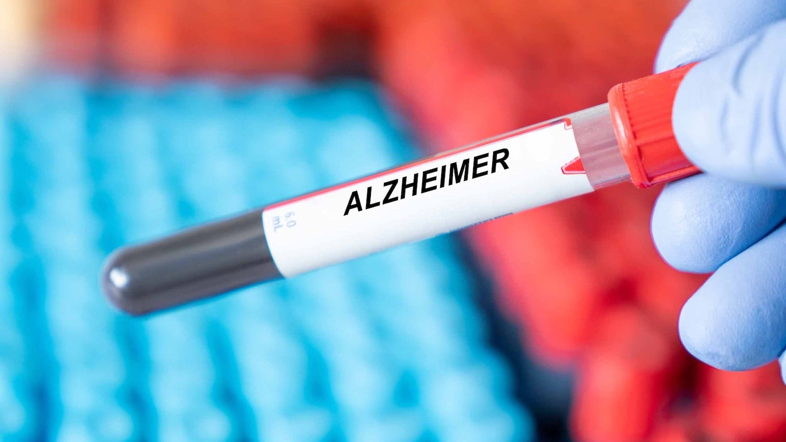 Novel Blood Test Identifies Alzheimer’s Disease Biomarker | Healthcare ...