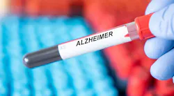 Blood Test Alzheimers