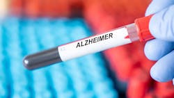 Blood Test Alzheimers 63b83ceadcb0c Blood Test Alzheimers 63b83ceadcb0c
