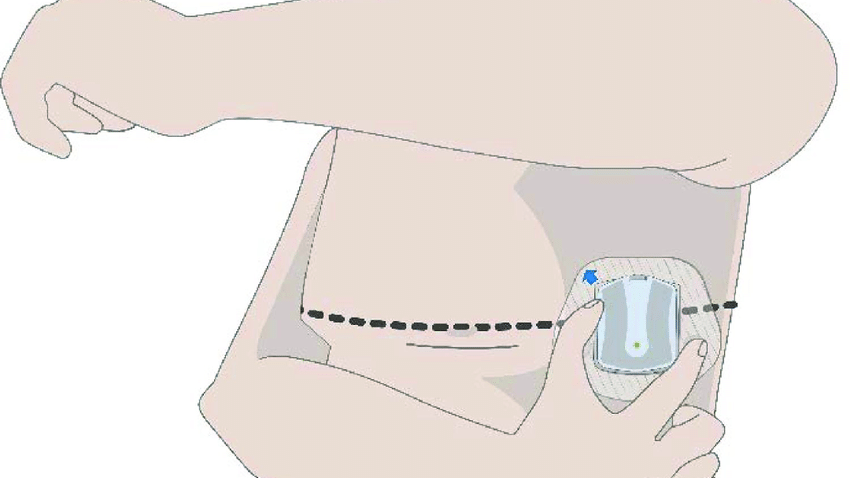 Zoll Medical 6408963a680a2