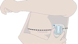 Zoll Medical 6408963a680a2 Zoll Medical 6408963a680a2