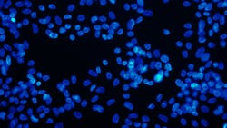 Dreamstime Xs 3586269 640b5452b2b9e Dreamstime Xs 3586269 640b5452b2b9e