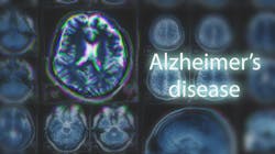 Dreamstime Xxl 113185305 640894d2c3351 Dreamstime Xxl 113185305 640894d2c3351