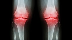 Dreamstime Xxl 59831383 64243d4b51e4d Dreamstime Xxl 59831383 64243d4b51e4d