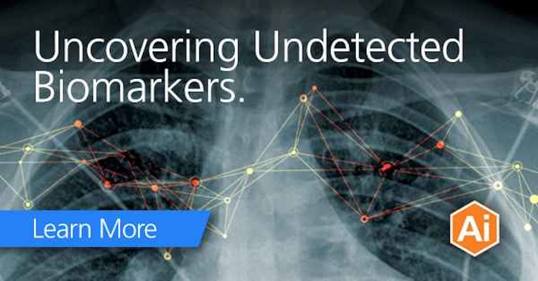 Carestream Uncovering Undetected Biomarkers