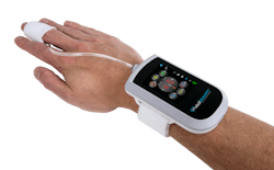 Caretaker Medical's VitalStream Caretaker Medical's VitalStream