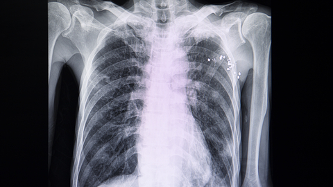 Dreamstime Xs 153846077 642f06db40096