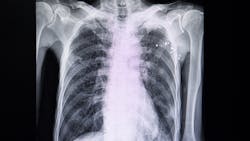 Dreamstime Xs 153846077 642f06db40096 Dreamstime Xs 153846077 642f06db40096