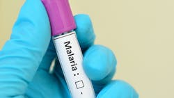 Dreamstime Xs 55650091 644bdd9dd8d3f Dreamstime Xs 55650091 644bdd9dd8d3f